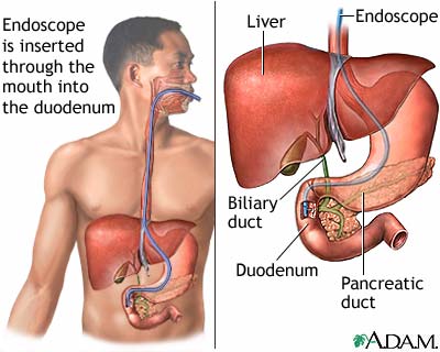 colonoscopy diagram